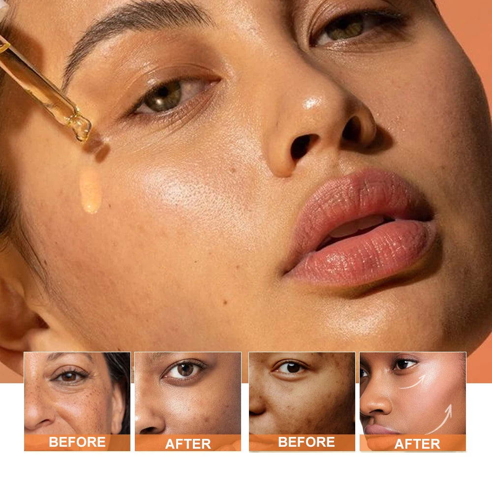 Adults' Herbal Face Gel Serum Infused With Turmeric Vitamin C Amino Acids & Minerals