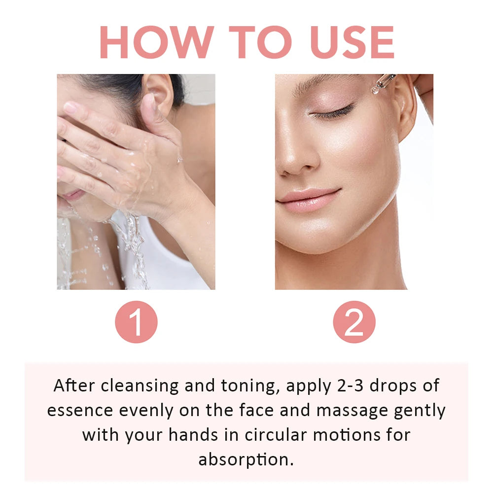 30ml Niacinamide Serum Melanin Removal Fade Melasma Dark Spots Corrector Shrink Pores Hyaluronic Acid Moisturizing Skin Care