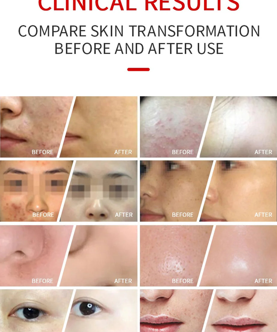 7 Colors LED Face Mask PDT Equipment SPA Facial Spray Device Skin Rejuvenation Light Facial Body Beauty Machines For Skin Care